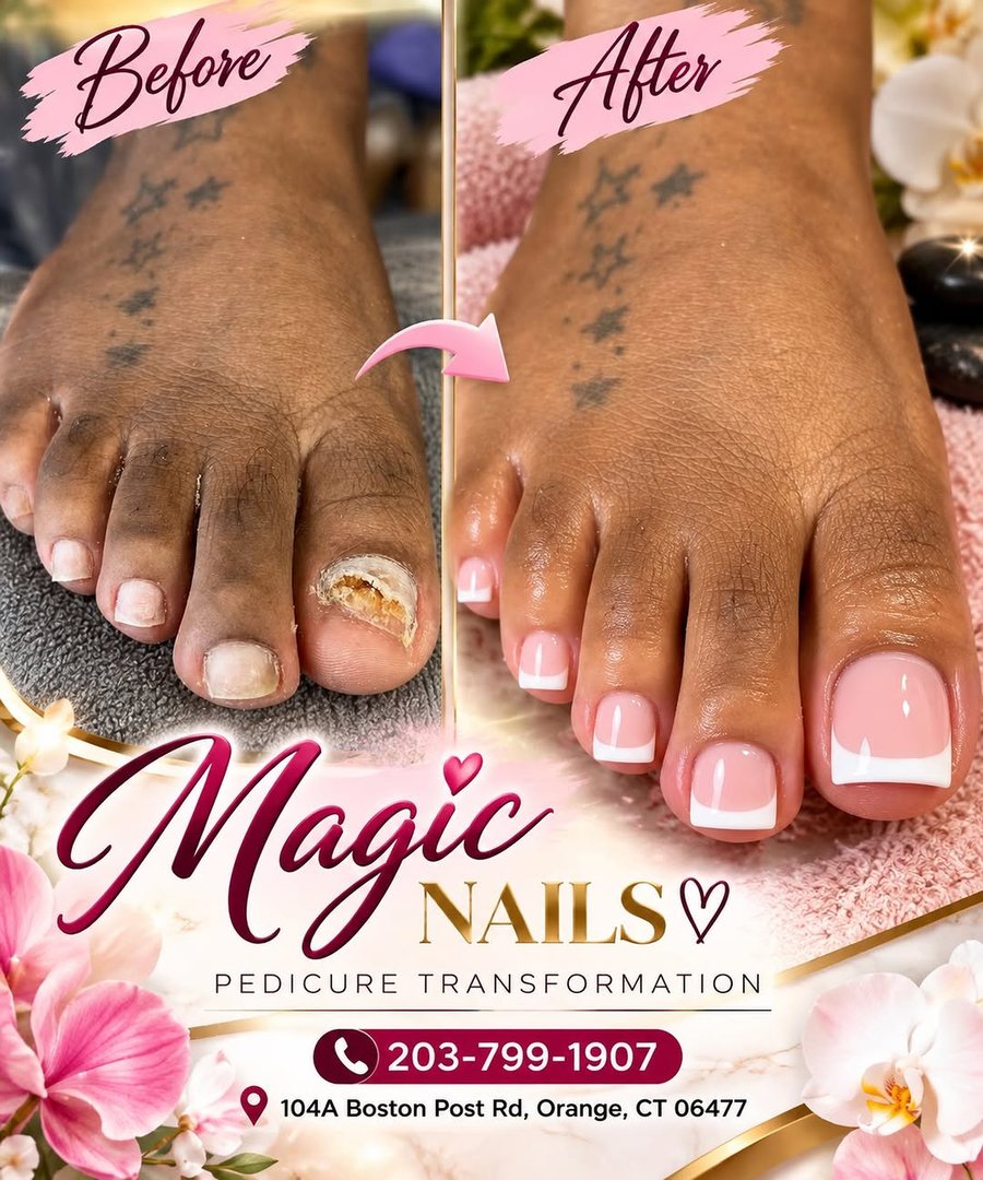 Feet before and after a pedicure with a French finish at Magic Nails